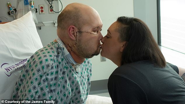 Mr James (pictured with his wife Meagan) spent just 17 days in intensive care