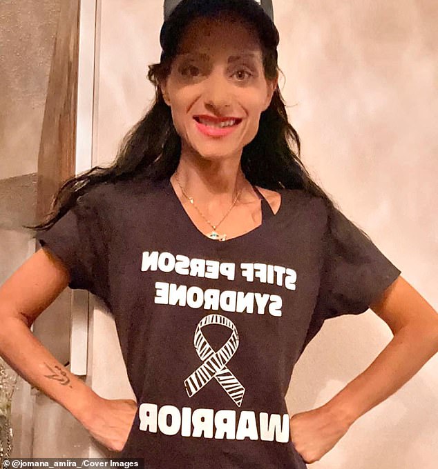 Ms. Houssari is just one of 330 Americans with stiff person syndrome.  When she was first diagnosed, her doctor had never experienced the condition