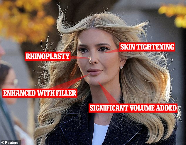Some of the procedures experts believed Ivanka had undergone included a non-surgical nose job, skin tightening under her eyes and fillers in her lips, chin and jaw.