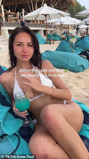 The OnlyFans star, 24, revealed her sudden weight loss and bruises on her legs in a clip of her relaxing at Sundays Beach Club in Bali