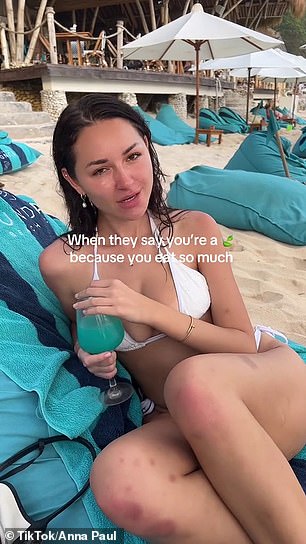 The OnlyFans star, 24, revealed her sudden weight loss and bruises on her legs in a clip of her relaxing at Sundays Beach Club in Bali