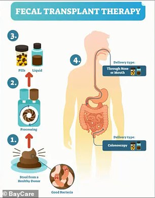 Good bacteria are extracted from a healthy donor and processed into pills or a liquid.  It is then administered to patients using an enema, a liquid administered through the rectum