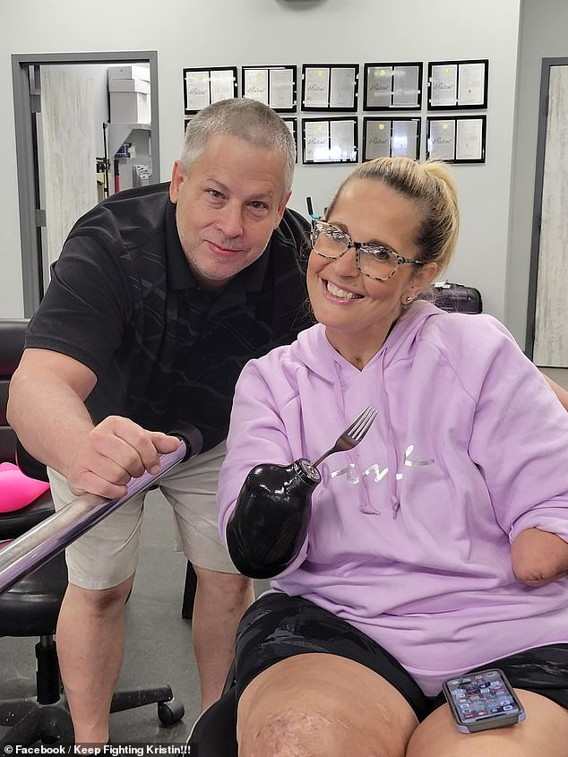 Ms Fox is pictured above holding a fork as she learns how to use her prosthetic limbs.  She said she now no longer uses the arms and only uses prosthetic limbs