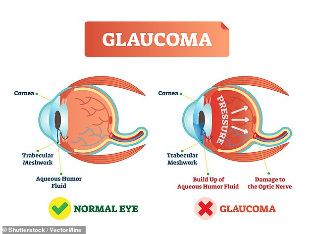 Nearly three percent of people with glaucoma have Charles Bonnet syndrome, and as many as 38 percent of people with some form of vision disorder experience visual hallucinations