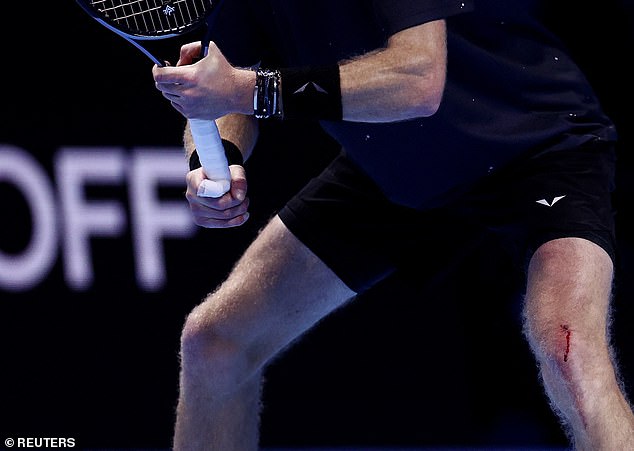 The world number five had to continue playing with a bleeding kneecap when he saw the nervous defeat