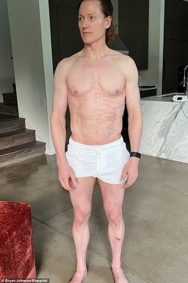 Bryan Johnson, 46, guzzles 80 vitamins and minerals a day and eats 30 pounds of pureed vegetables a month.  He also wears a device on his penis every night that measures erections