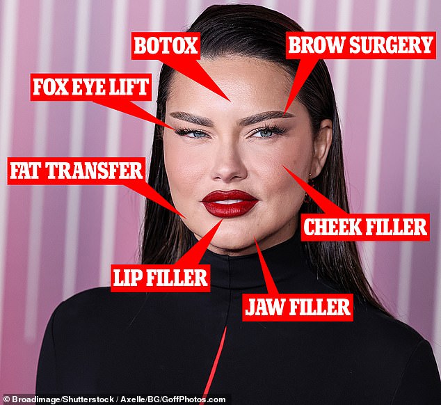 Now plastic surgeons have weighed in, believing Adriana got Botox in her forehead;  lip, jaw and cheek filler;  and a fox eye lift