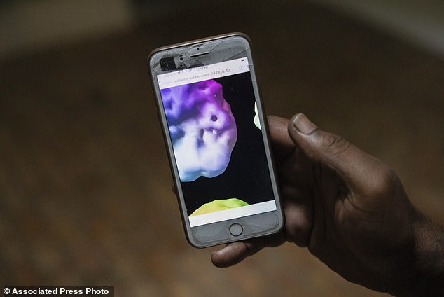 He shows scans of his brain injury on his phone but says he cannot afford to treat it