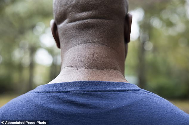 Williams has a visibly swollen neck from an old football injury but has struggled to get paid