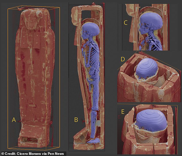 Minirdis was the scion of a holy family and would have followed the job of his father, Inaros, a priest of the Egyptian fertility god Min.  But he died around the age of 14 and his mummified remains were buried in the Akhmim Cemetery, Upper Egypt, where they were found in 1925.