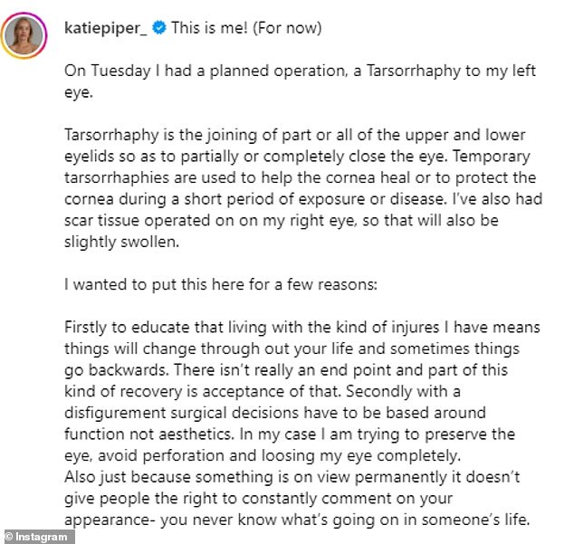 1700703589 908 Katie Piper reveals shes undergone surgery to avoid losing her