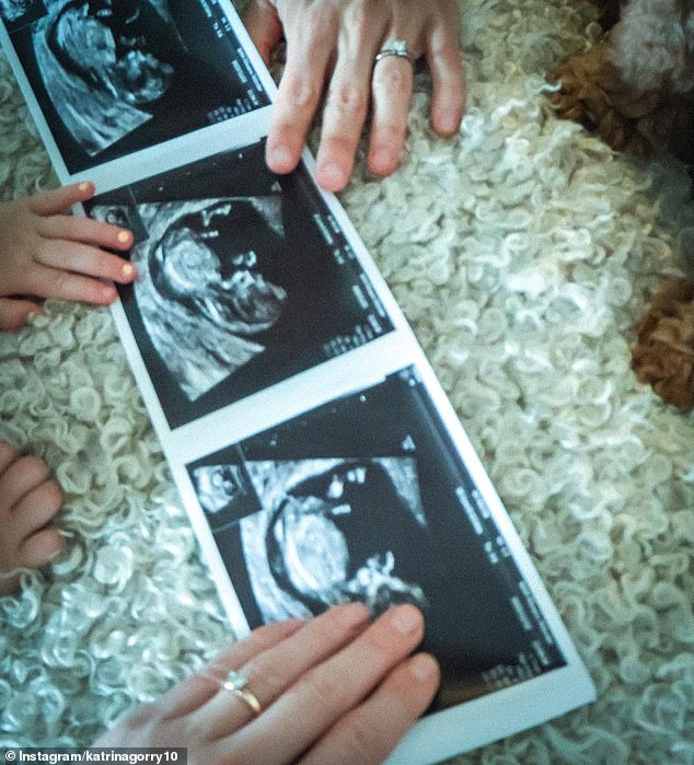 Gorry's Instagram followers were treated to ultrasound images of the baby, who is due next year