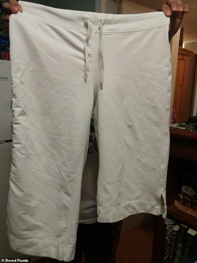 It is common for clothing to shrink, but in this person only one of the trouser legs became shorter