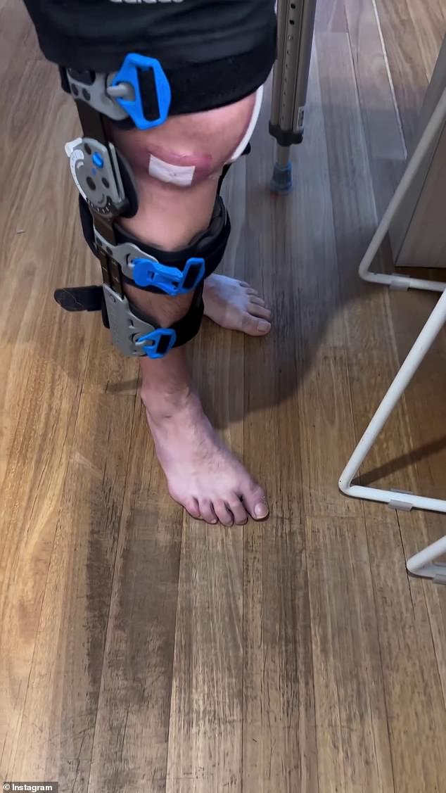 Feidel shared an image of a leg brace and told fans at the Tour De Cure lunch that he had surgery 'tomorrow'