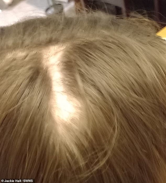 The 11-year-old's hair got stuck in a ticket slot as she bent down to pick up a receipt at Tenpin, a bowling alley in Coventry, West Midlands