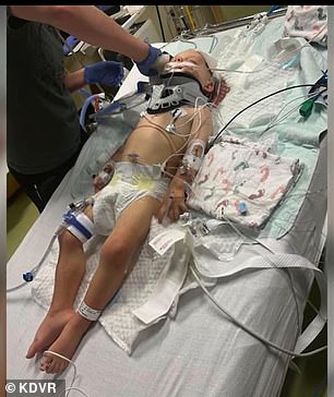 1701046023 893 Colorado boy 2 is left horrifically injured after suffering severe beating