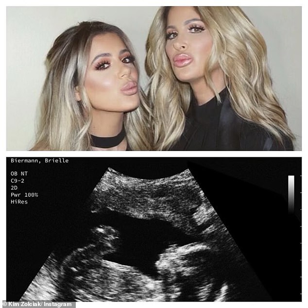 1701231354 556 Kim Zolciak outrages fans after posting fake sonogram implying daughter