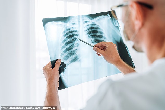 Cancer Research UK urged more action to speed up diagnosis, get people treated quickly and recruit an additional 16,000 full-time cancer staff by 2029.  Pictured: Doctor examining scan (stock)