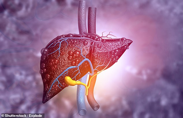 The breakthrough therapy is the first to treat cirrhosis, the scarring of liver tissue caused by heavy drinking, fatty diets and long-term infections by the hepatitis B and C viruses.