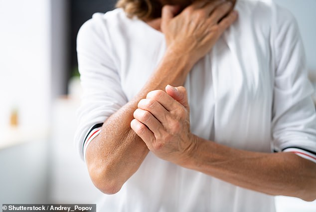 Scientists from Harvard University discovered that the itching that occurs in patients with eczema may be due to the bacteria Staphylococcus aureus, which one in three Americans carry.