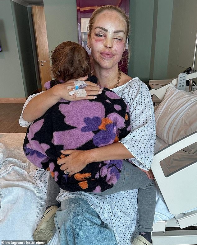 Candid: The presenter shared a series of photos of her eyes after the procedure as she admitted she still finds surgery 'mentally tough' after her acid attack