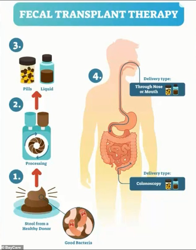 Good bacteria are extracted from a healthy donor and processed into pills or a liquid.  It is then administered to patients using an enema, a liquid administered through the rectum