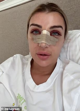 MAFS bride Tamara Djordjevic, 31, (pictured) insisted she 'couldn't be happier' as she showed off the painful-looking aftermath of her nose job