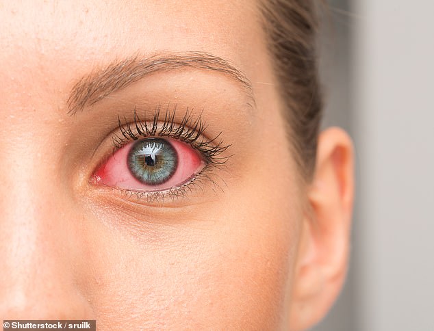 Syphilis in the eye occurs in only four percent of people with the infection