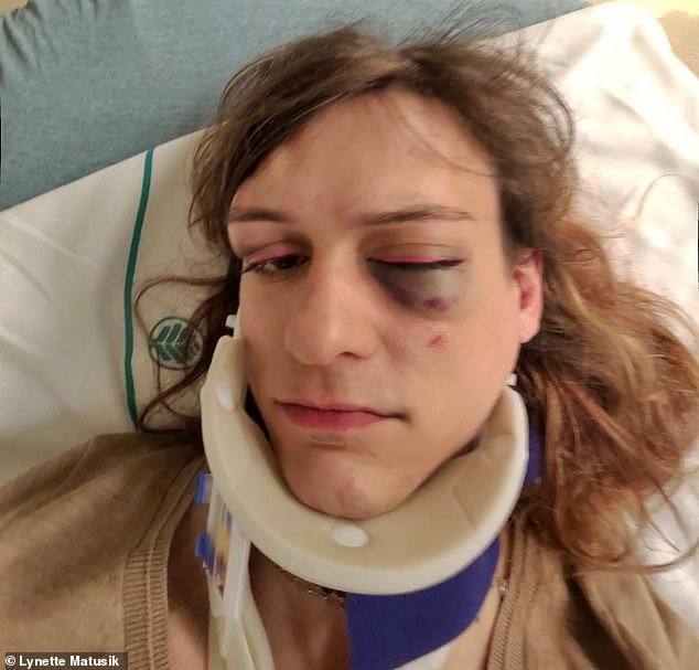 Lynette Matusik, who captured part of the attack with a camera in her Meta Smart Glasses, claims she was the victim of a hate crime