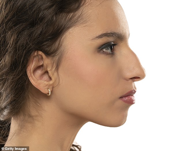 A deviated nasal septum occurs when one nasal passage is narrower than the other.  It can occur naturally or can be caused by an injury to the nose