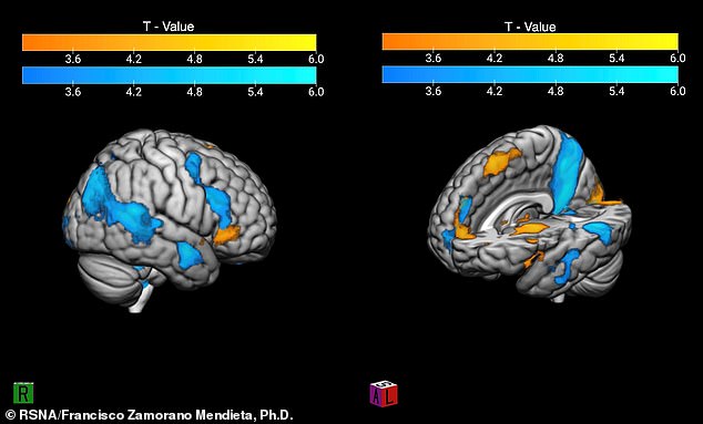 When study participants watched their team score goals, orange areas of their brains lit up.  When their team's opponent scored, the blue zones were more active