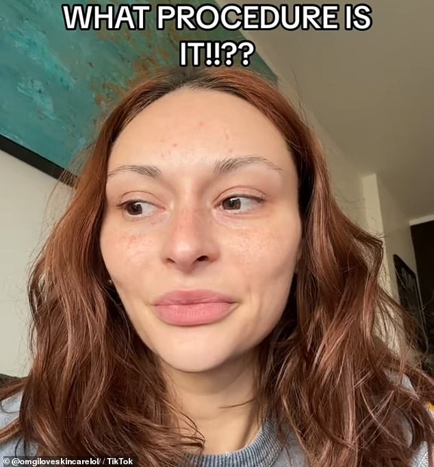 The TikTok creator asked what procedures cause celebrities' resting faces to have flared nostrils and high cheekbones, creating a pinched lip effect