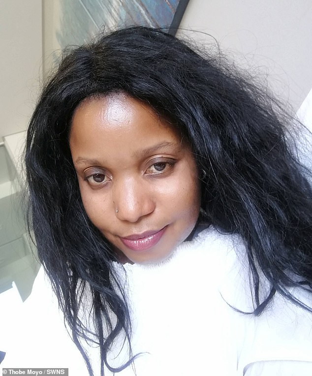 Thobe Moyo, 38, from Cape Town, South Africa, says laser hair removal left her with painful 'checkerboard' burns on her face and neck