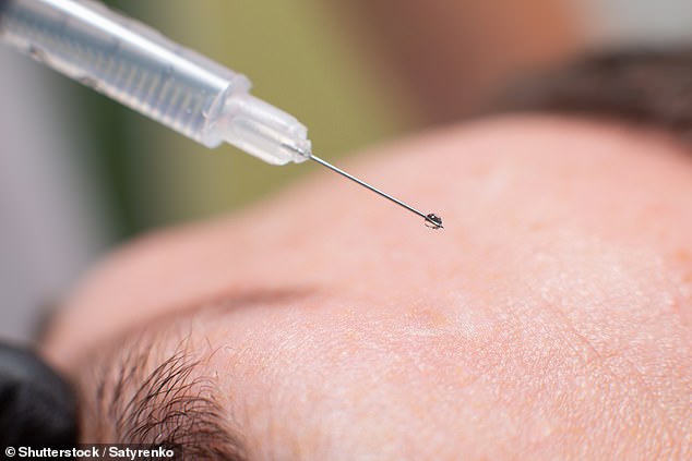 Botox – the brand name for injectable botulinum toxin type A – works by paralyzing the muscles into which it is injected (stock photo)