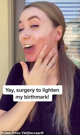 In her TikTok videos she talks a lot about the condition (in the photo you see her before the laser surgery)