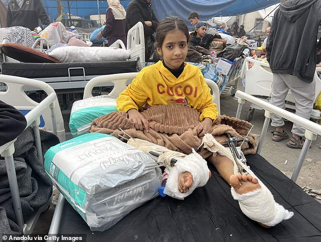 Some injured Palestinians are seen at Al-Shifa Hospital, where thousands of injured and displaced people reside