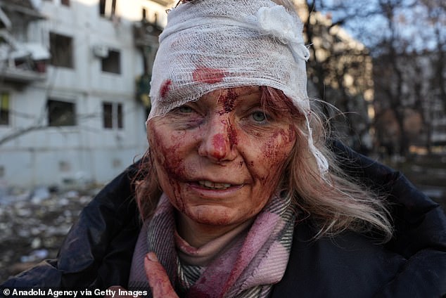 An injured woman is seen as an airstrike damages an apartment building outside Kharkov