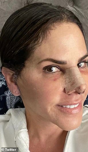 The reality star and show brand CEO has been open about the work she underwent on the Bravo series;  Pictured after the procedures