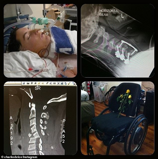 Brice shattered, shattered two vertebrae and completely severed his spinal cord in the motorcycle accident