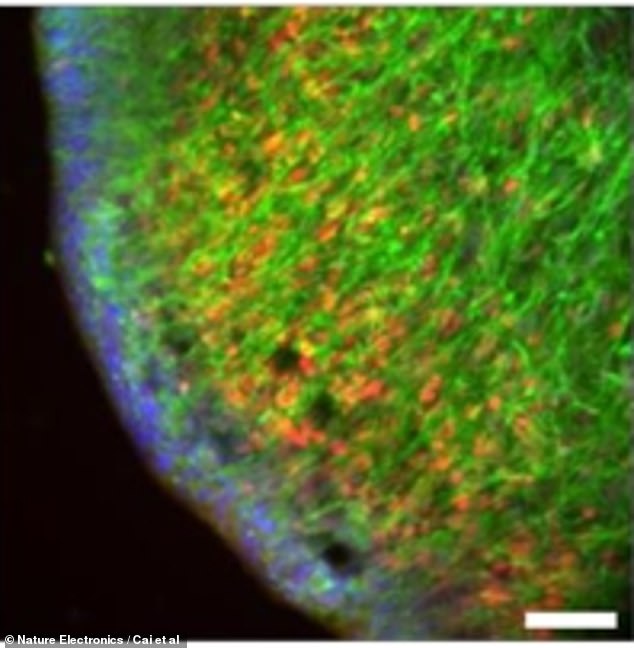 After three months of development, the brain organoids contained neural progenitor cells that can grow into neurons, as well as mature neurons.