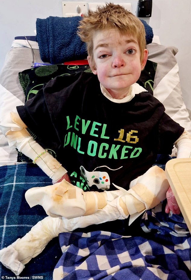 Despite the heartbreaking condition, Rhys has remained brave through the pain and even made arrangements for his own funeral