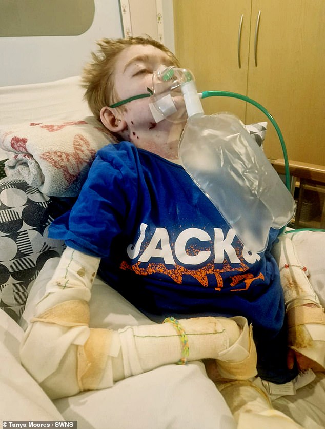 Rhys developed sepsis and pneumonia and was rushed to hospital on November 4.  The doctors said there was nothing more they could do and his treatment was stopped.