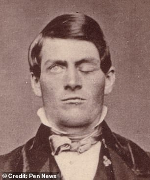 Phineas Gage was paving the way for a new railroad in Vermont on September 13, 1848, when an accidental explosion turned his life upside down