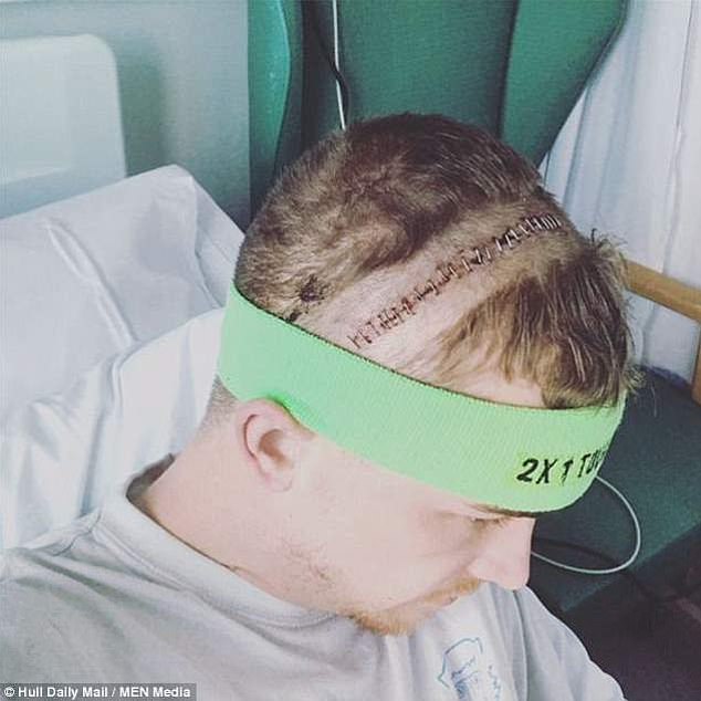 After being diagnosed in January 2018, his tumor was removed two months later, which brought a whole new ordeal of having to stay awake while under the knife.