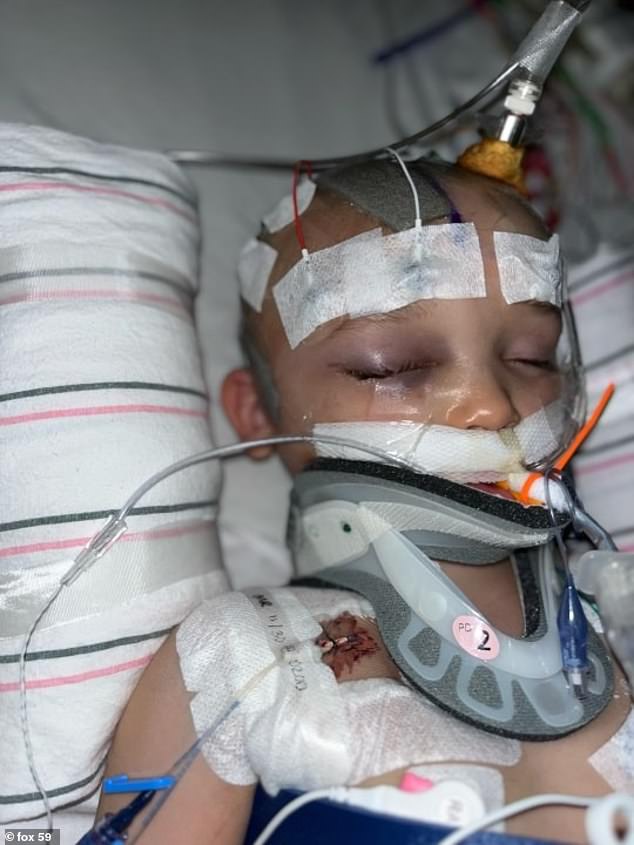 Noah Brown was sedated due to his head injury and suffered multiple seizures as a result of the violent attack