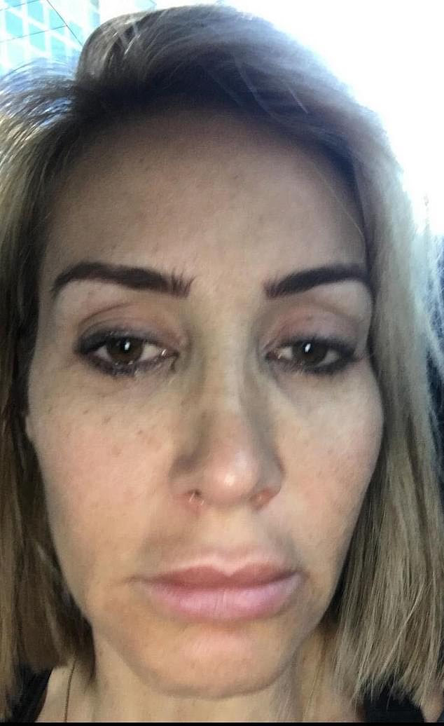 Amanda said she was hungover for days and had toxic thoughts when she was a drinker - she is pictured here after a night out