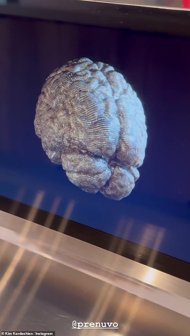 She also uploaded a second movie filming a computer image of her brain and can be heard saying: 'This is a full video of my brain on a screen and this explains everything about it'