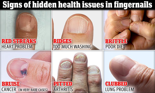 The image above highlights six nail changes that could indicate a serious problem in the body