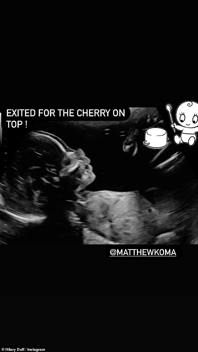 The artist announced earlier this month that she was expecting to add another child to her family, and she also shared a photo of an ultrasound, which she called 