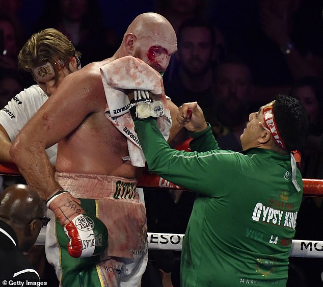 Fury suffered horrific cuts to his eye during one of the toughest fights of his undefeated career